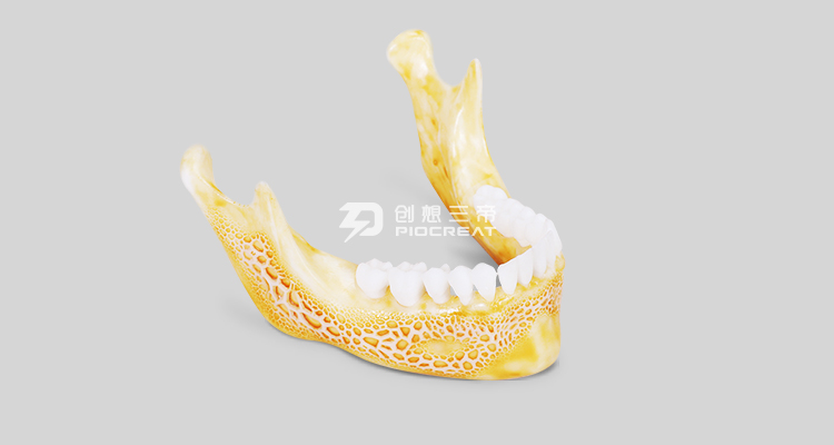 九游-3D打印技术在医疗行业内哪些领域发展比较好